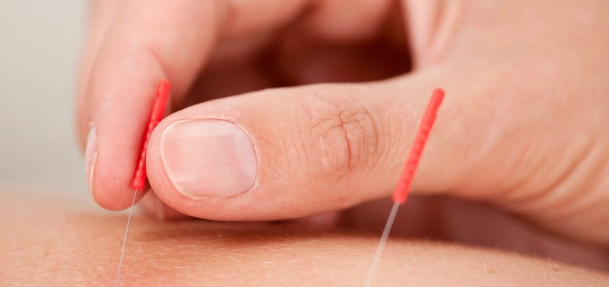 acupuncture Discount for First Time Patients